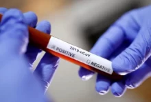 Coronavirus Test 1 220x150